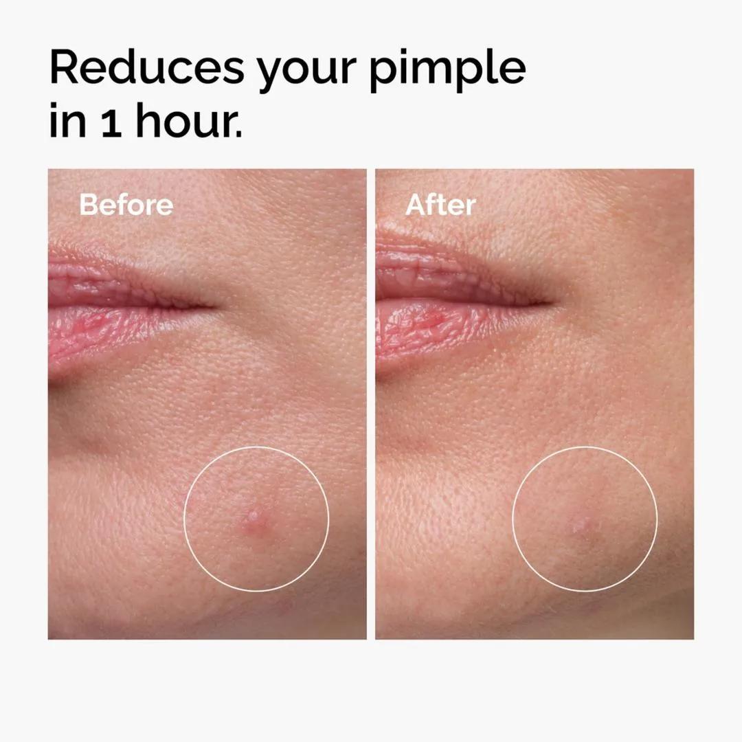 THE ORDINARY SULFUR 10% POWDER TO CREAM CONCENTRATE miniatura 3